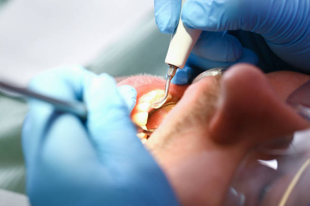 Best Emergency Dentist for Special Needs Patients in Suffield Depot, CT